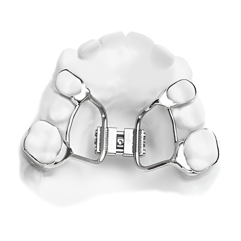 Aparaty podniebienne - Ortodoncja Kalisz